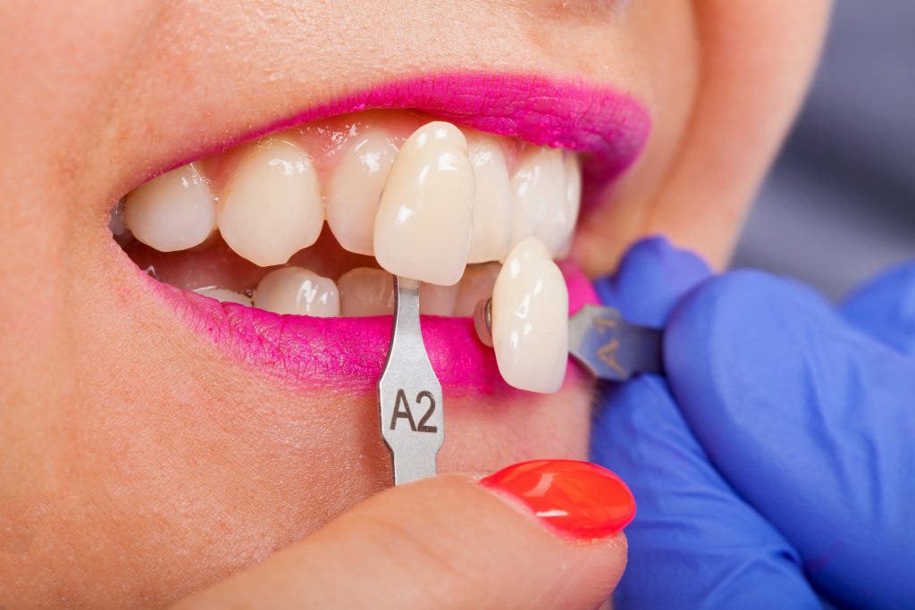 Cosmetic-Dental-Treatment